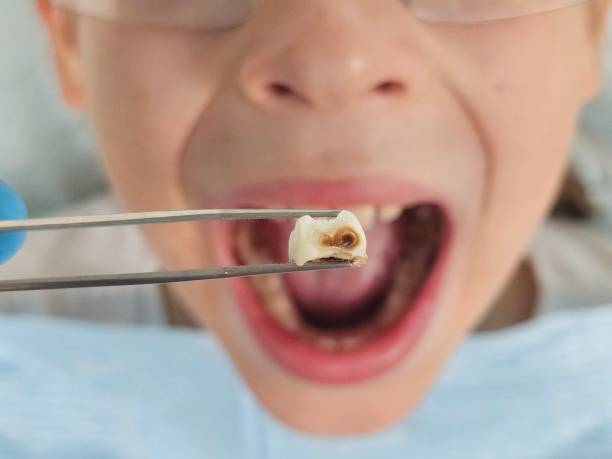 Best Emergency Dentist Near Me  in Arnold Line, MS
